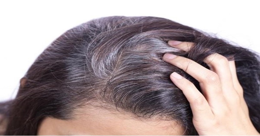 hà thủ ô ngăn chặn tóc bạc sớm